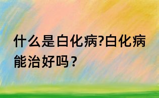 什么是白化病?白化病能治好吗?