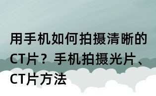 用手机如何拍摄清晰的CT片?手机拍摄光片、CT片方法