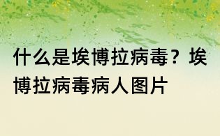 什么是埃博拉病毒?埃博拉病毒病人图片